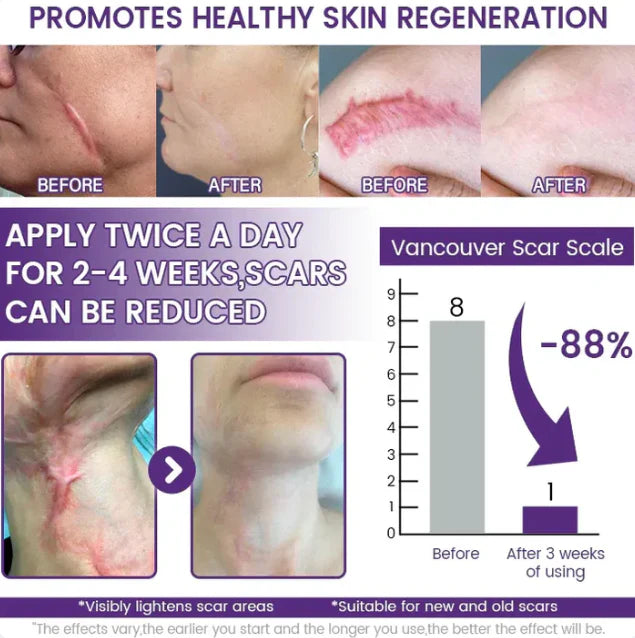 ReGenScar clinical trial results - 8000 participants dermatologist approved